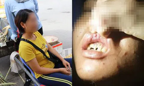 Nữ chủ quán bánh xèo nghi bỏ đói, đánh đập dã man 2 nhân viên: Những lần bắt xe ôm 'trốn chạy' trong đêm